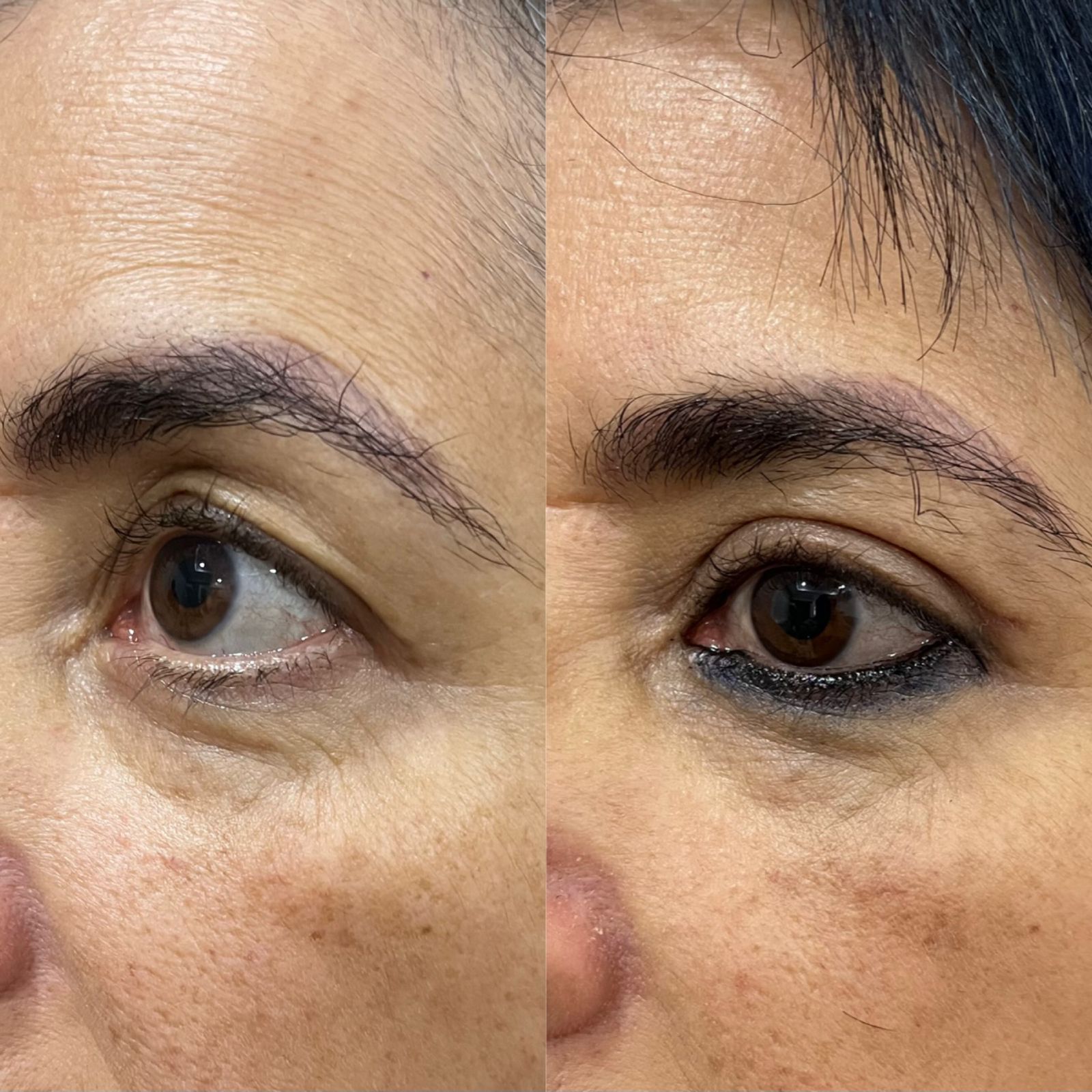 otoplastia reconstructiva