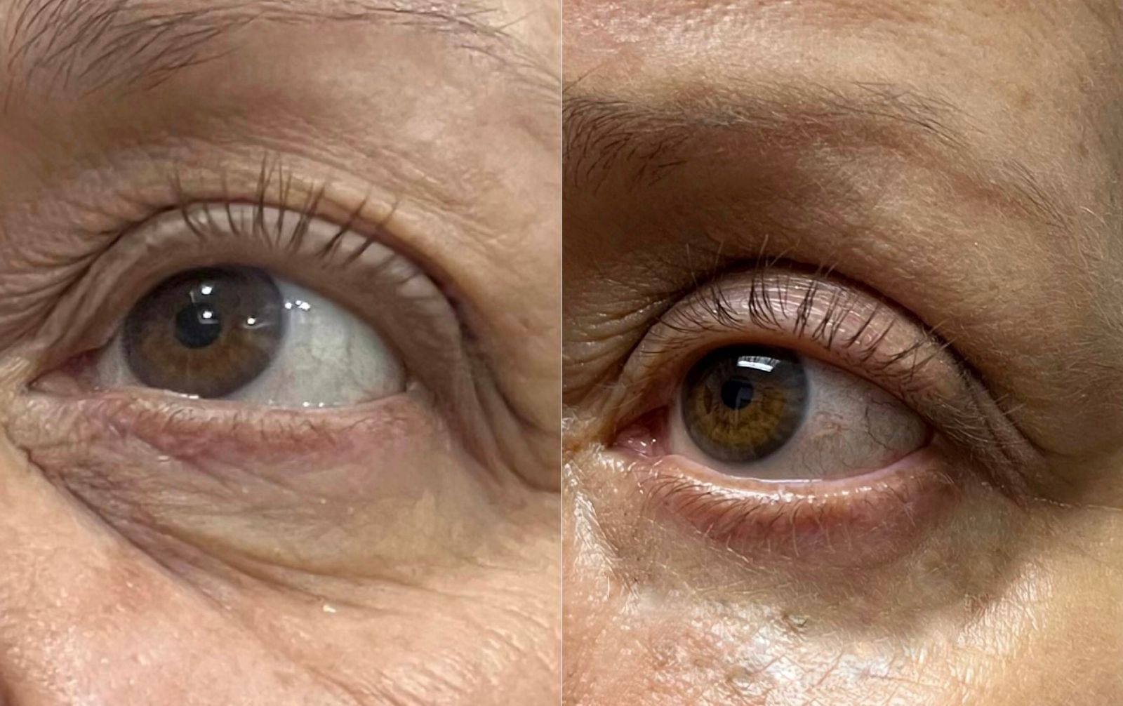 otoplastia reconstructiva